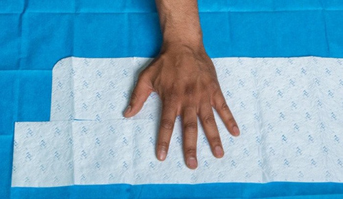 Water-Jel - Steriler, kühlender Gel-getränkter Brandwundenverband - 20 x 55 cm - B0820